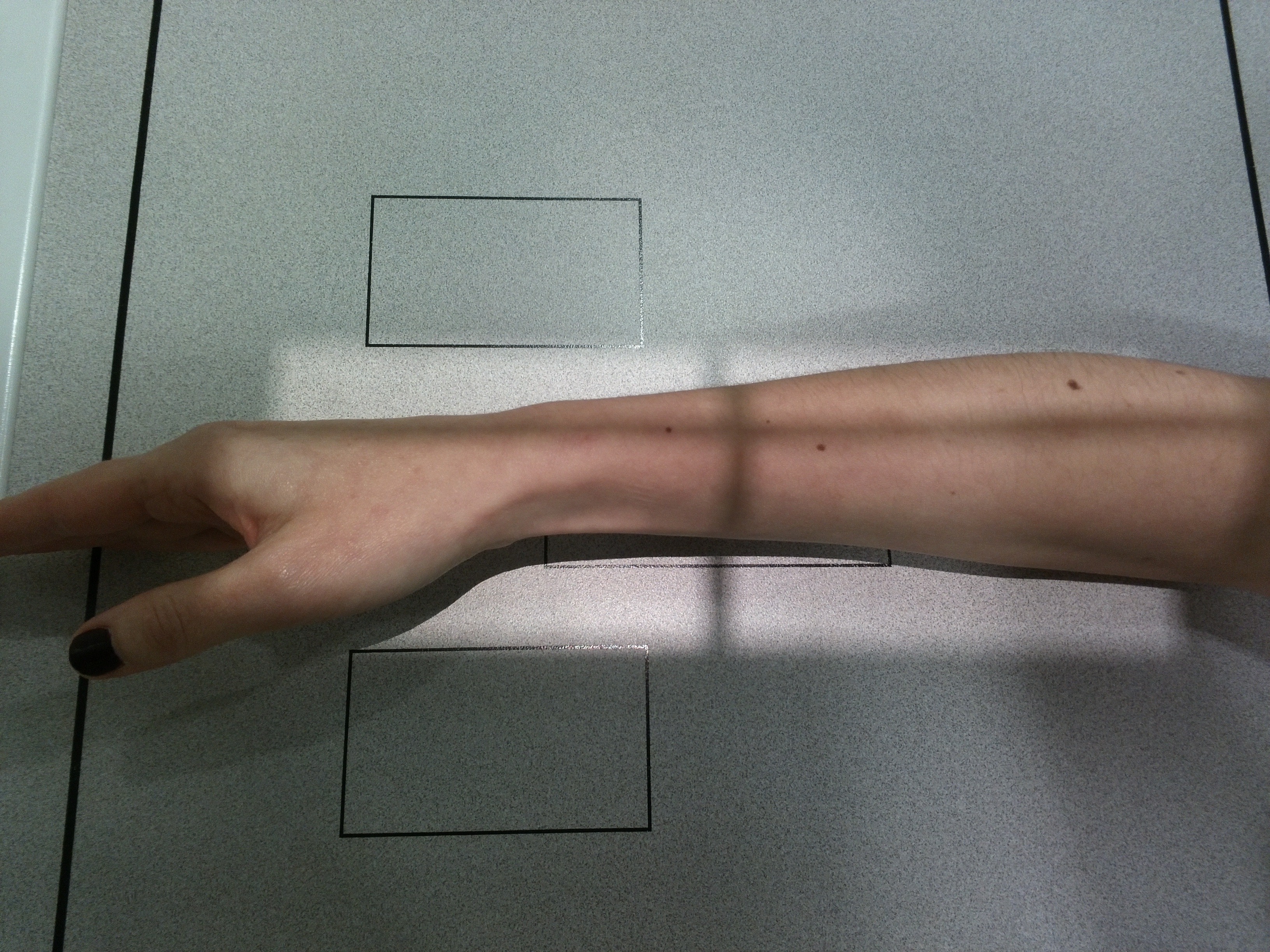 Radiografía Lateral Antebrazo